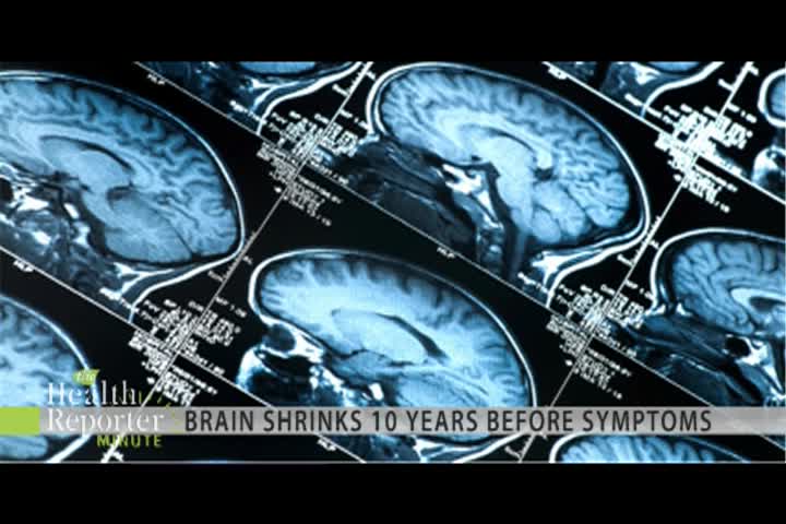 Thumbnail image for The Health Reporter: Alzheimers Predictor