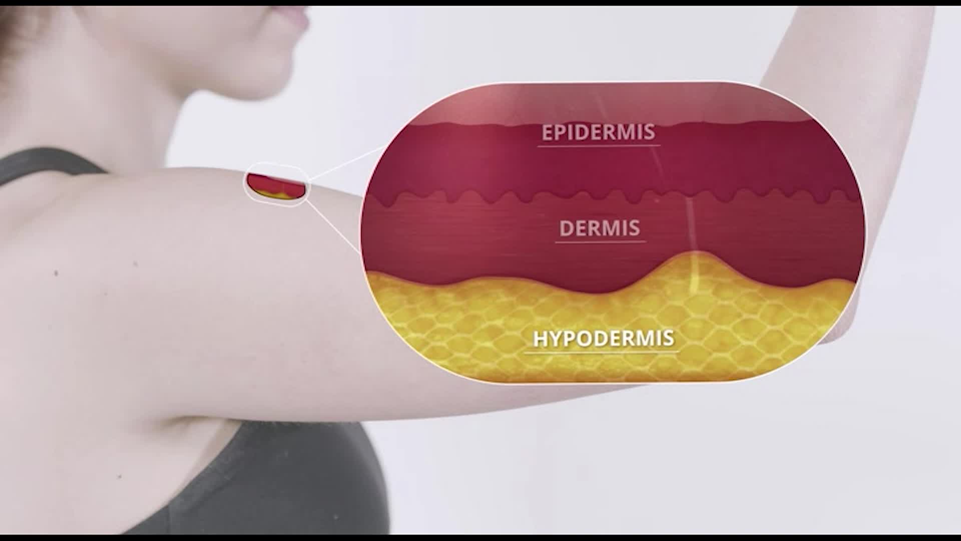 The Human Body: The Skin